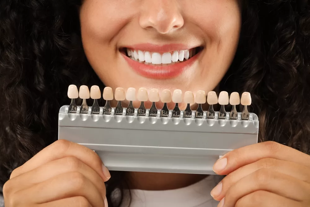 porcelain veneers