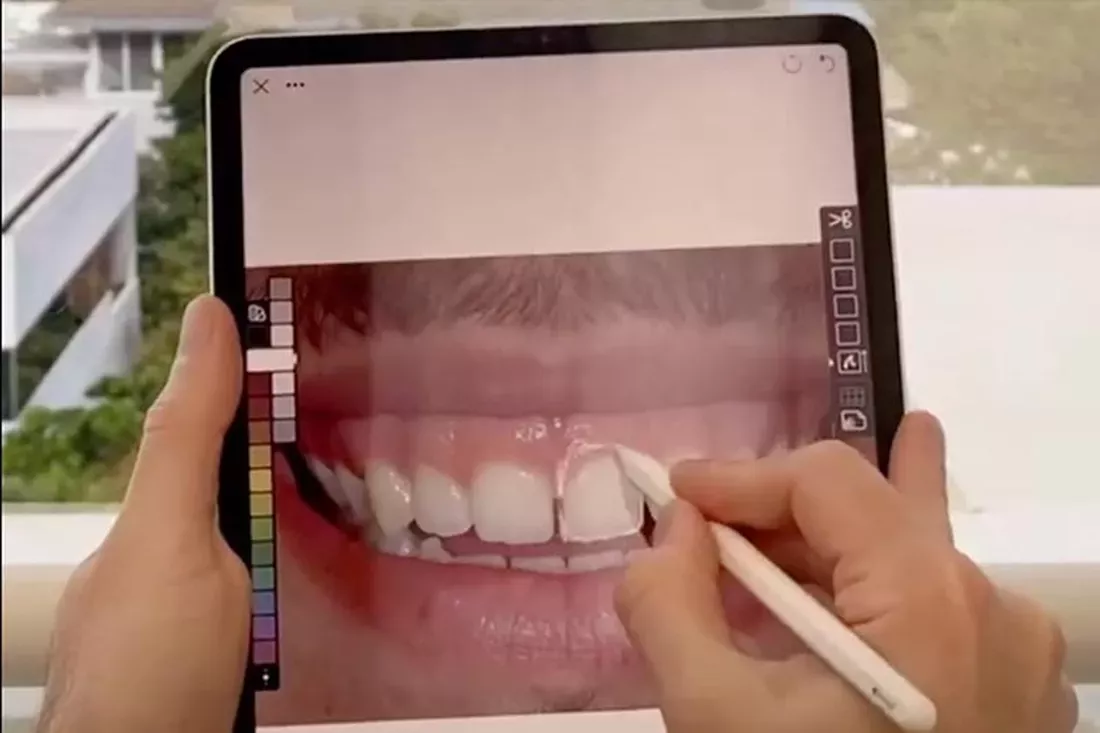 digital smile design Miami