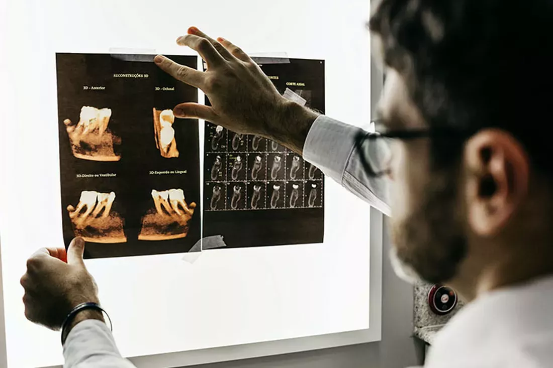 what is a prosthodontist