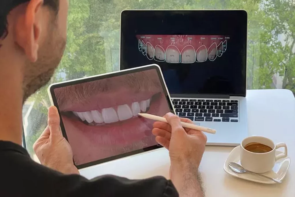 Digital Smile Design