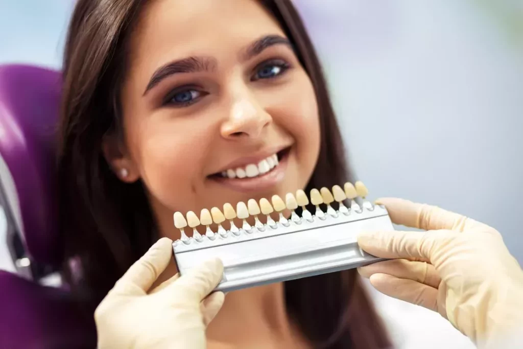 porcelain veneers