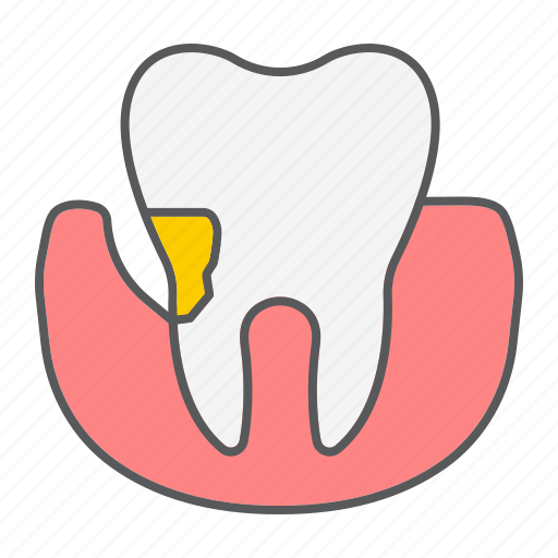 Periodontal Tooth Disease Plaque