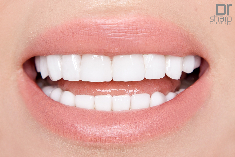 porcelain veneers cost in Miami