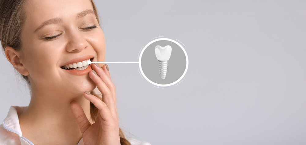 Dental Implant Specialist in Miami