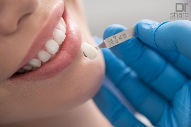 dental crowns miami