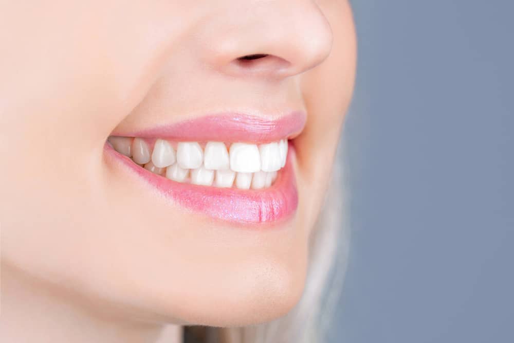 Teeth in a Day