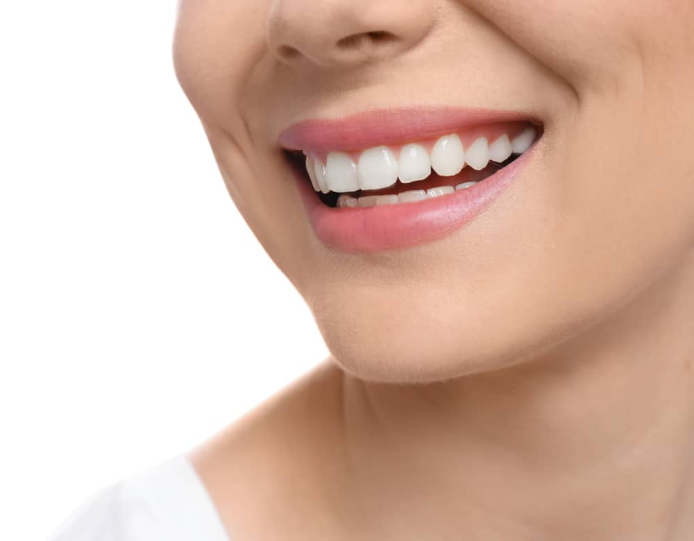 Hollywood Smile in Miami