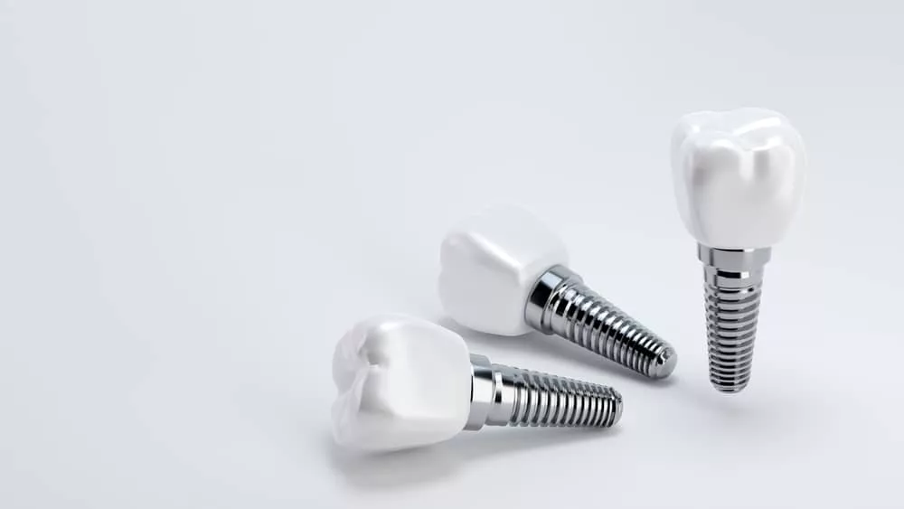 Dental Implants
