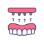 Dental Implant Miami