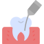Root Canal