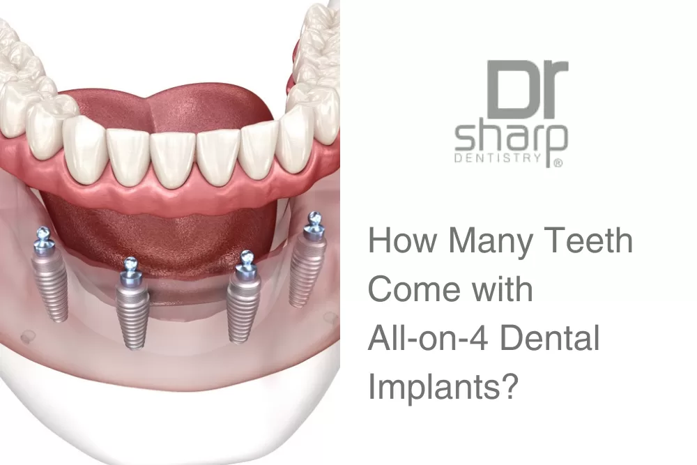 dental implants