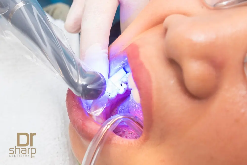 Resin Bonding