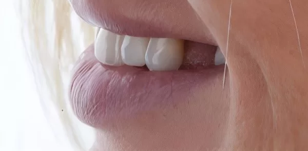 after treatment patient_smile