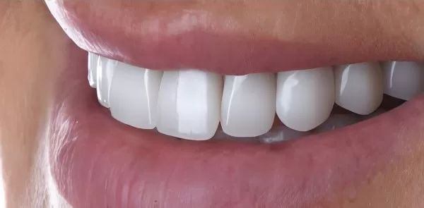 after treatment patient smile