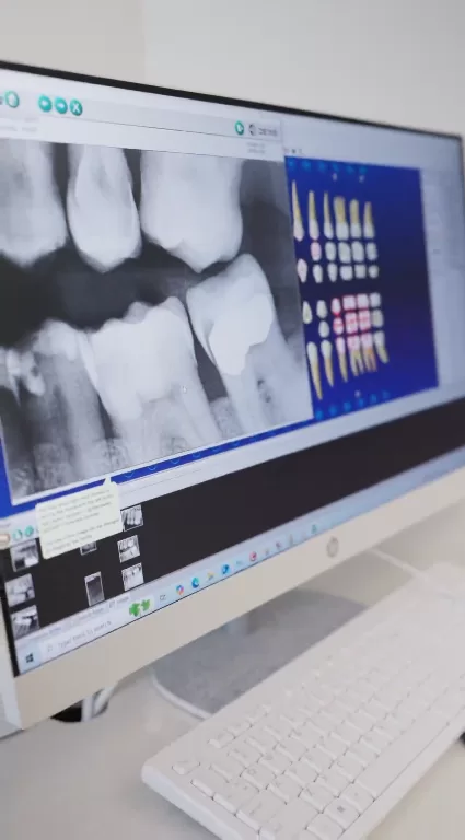 Teeth xray