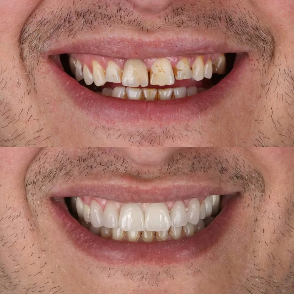 mouth reconstruction treatment
