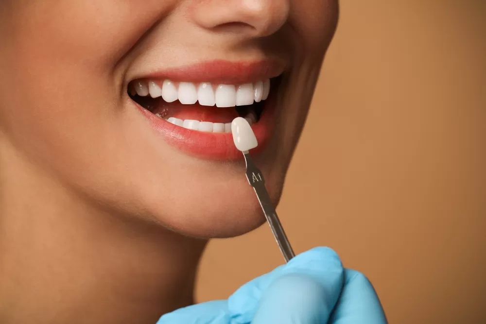 veneer Miami doctor