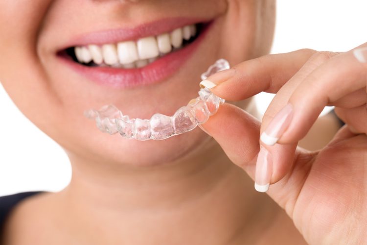 invisalign_miami