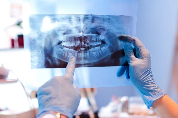 miami oral-surgery
