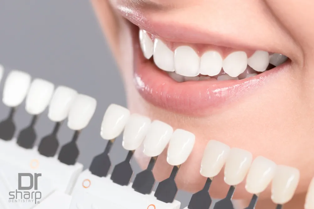 Porcelain Veneers Cost Miami