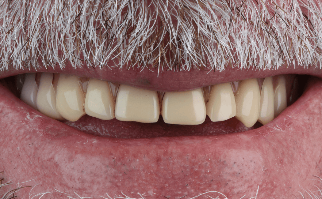 Before image
