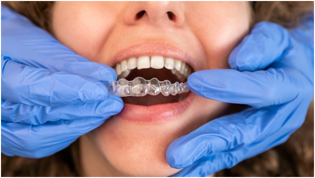Invisalign treatment