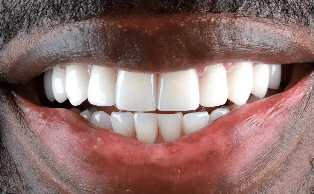 After dental treatment