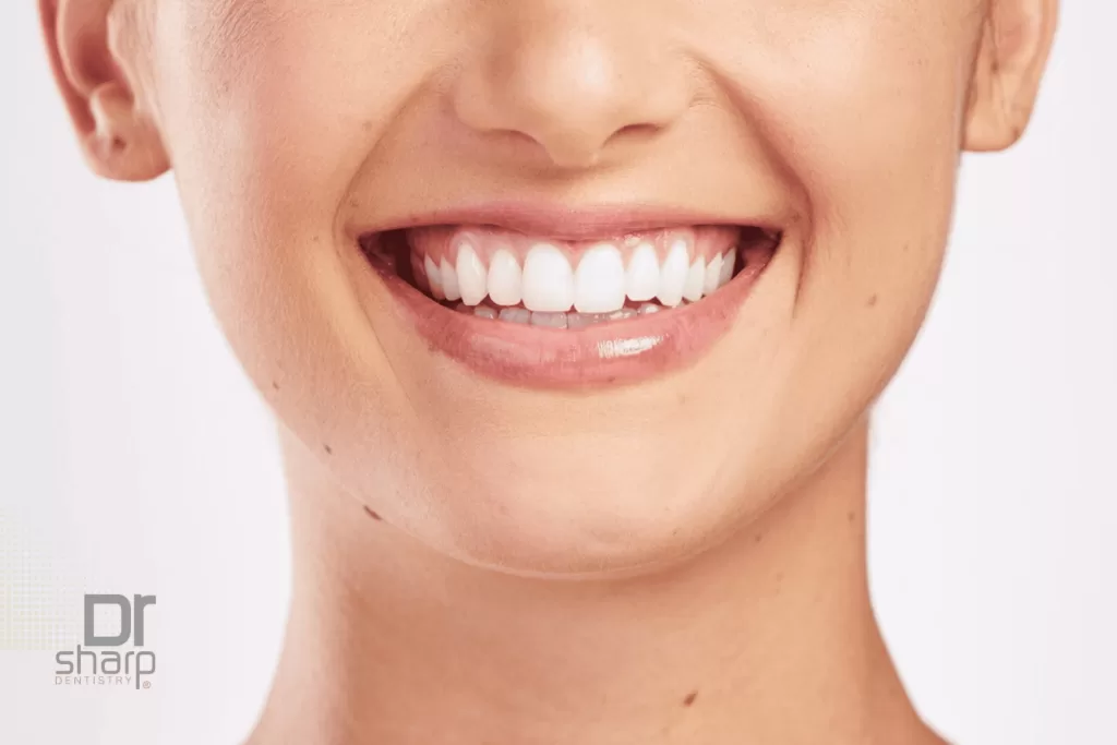 Hollywood smile veneers Miami