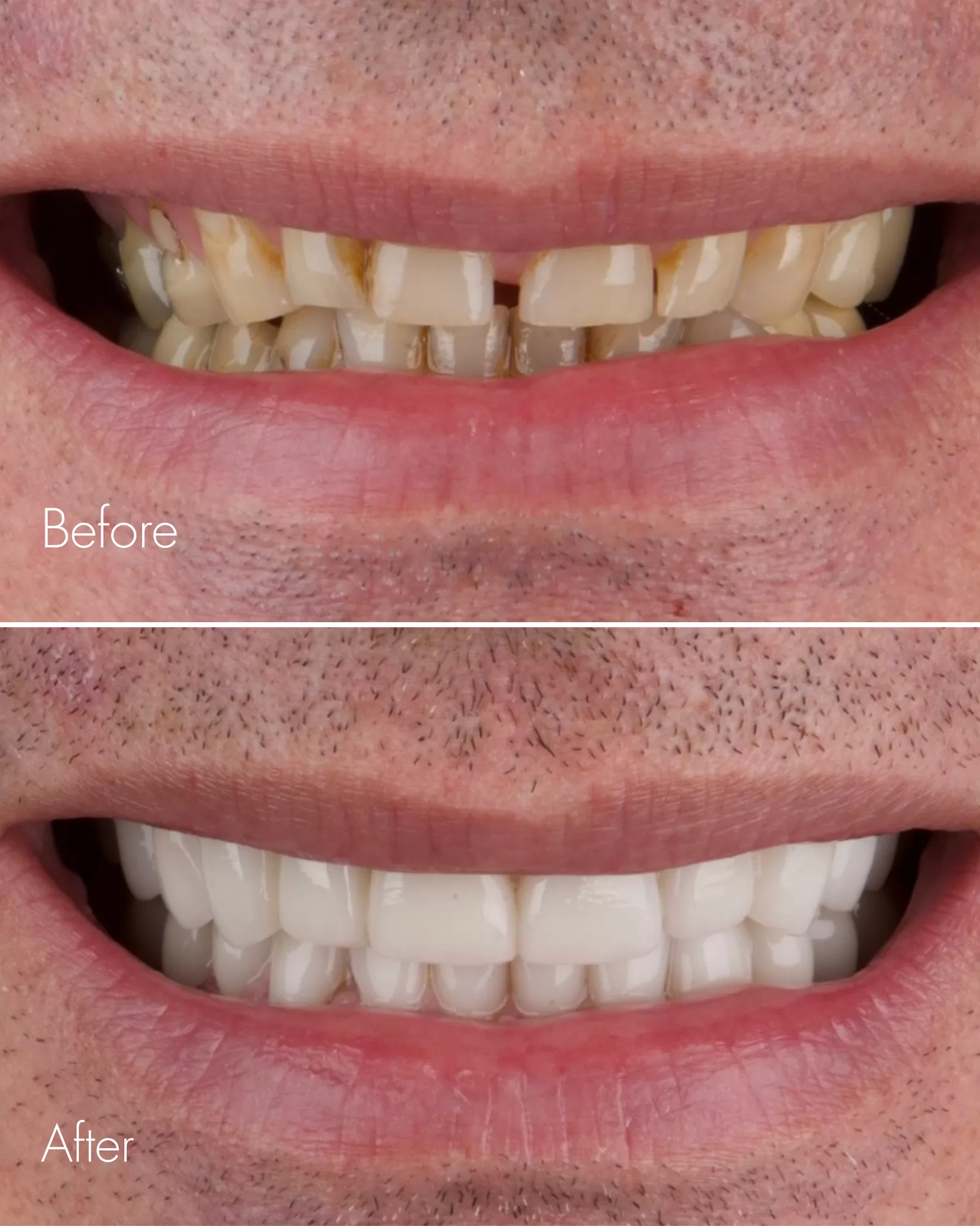 Dr Sharp Patient Before After