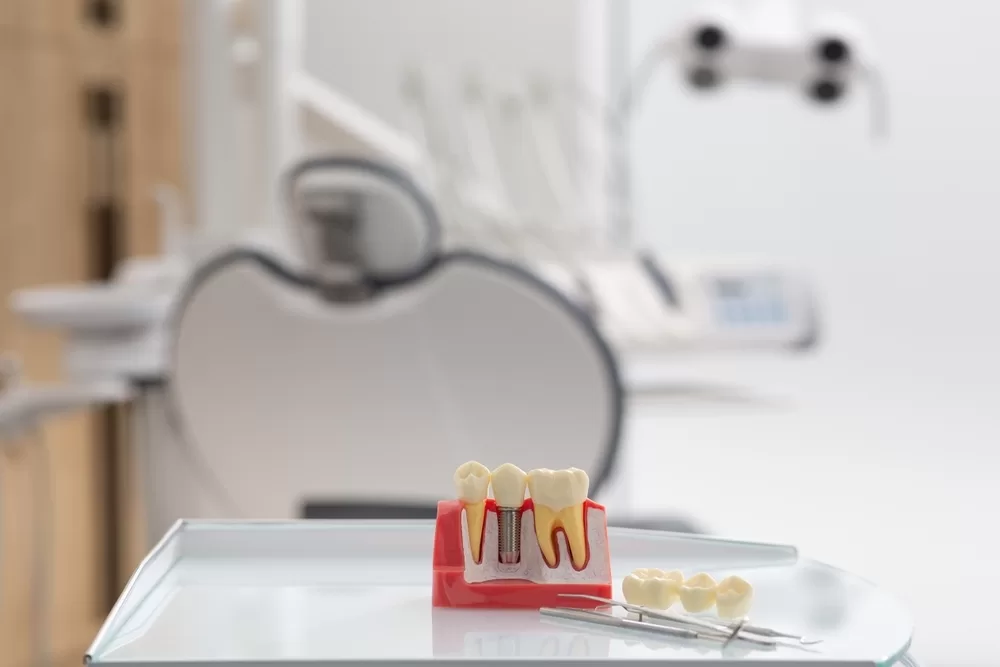 Dental Implants with Diabetes