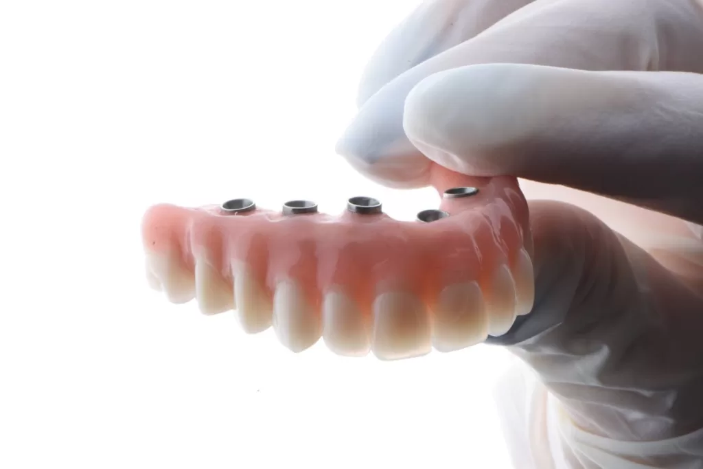 dental implant consultation Miami