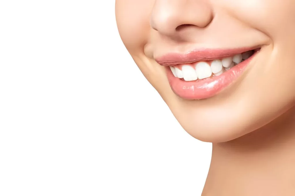 Smile Makeover Cost in Miami