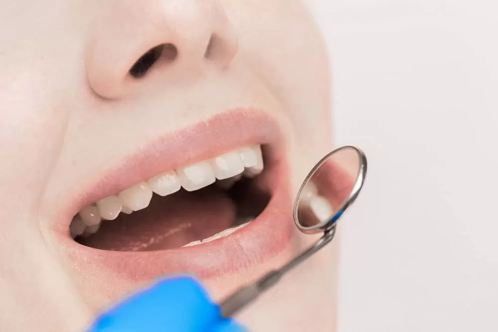 Oral Hygiene Miami FL