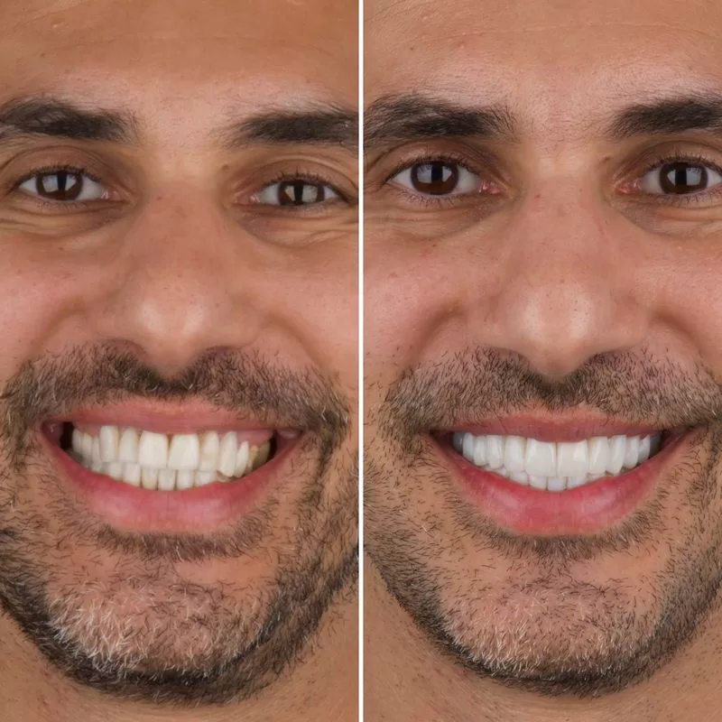 Periodontal Treatment