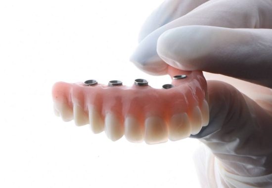 Dr Sharp -dental-implants-All-on-four-01 Dr Sharp -dental-implants-All-on-four-01