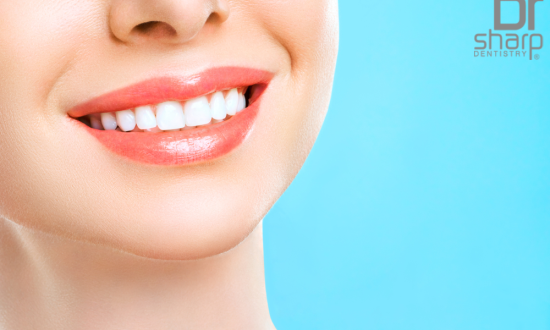 Dental Veneers